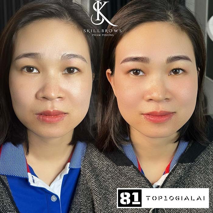 Ms Phượng Clinic & Spa