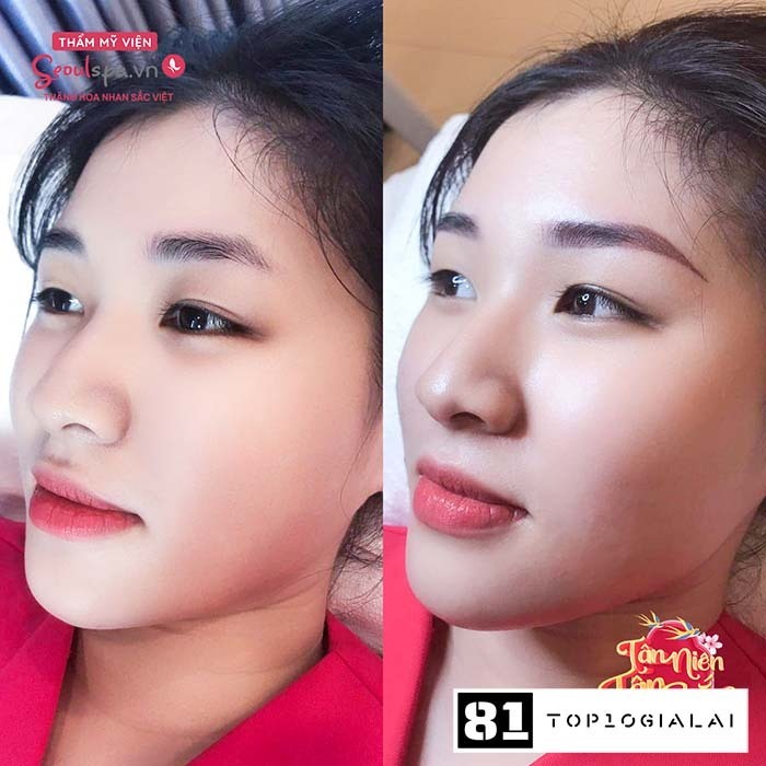 seoul spa phun chân mày gia lai