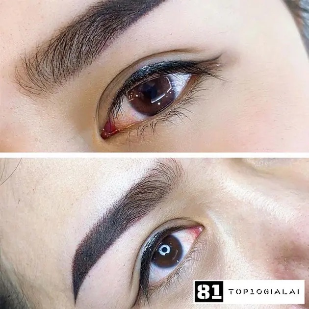 viện thẩm mĩ an an phun chân mày gia lai