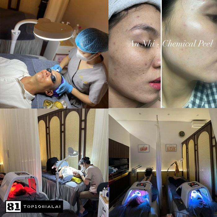 An Nhi - Trị Mụn Cam Kết