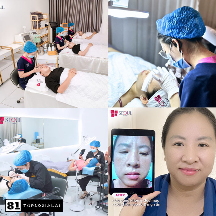 Thẩm Mỹ Viện Seoul Center Gia Lai