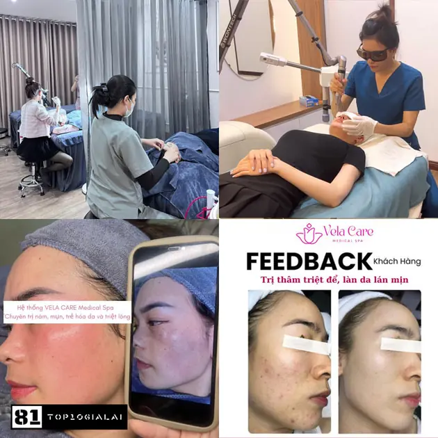 Thủy Tiên Spa - Điều Trị Nám Da Tàn Nhang